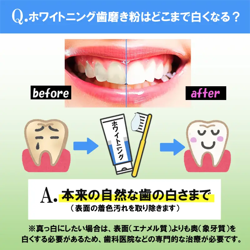 ホワイトニング歯磨き粉はどこまで白くなる？