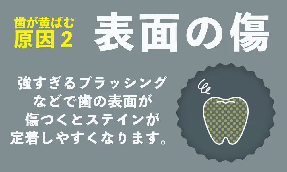 歯が黄ばむ原因２：歯の表面の傷